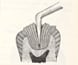 Textbook showing the use of gold for tooth fillings. Textbook showing the use of gold for tooth fillings.